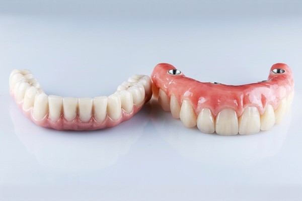 Essential Things To Know About All On   Dental Implants