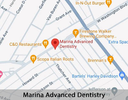 Map image for Options for Replacing Missing Teeth in Marina Del Rey, CA